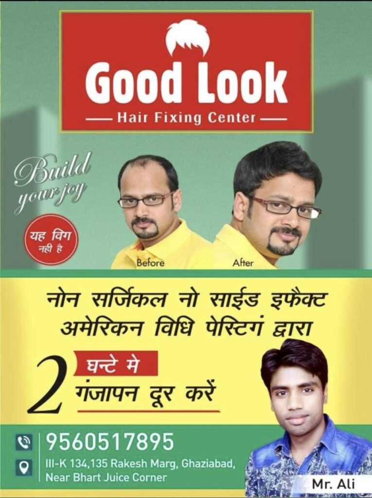 Best Hair System In Ghaziabad