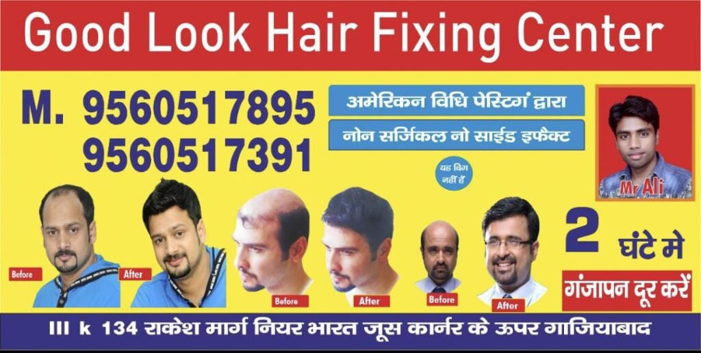 Hair Systems In Ghaziabad: The Natural-Looking Hair Restoration