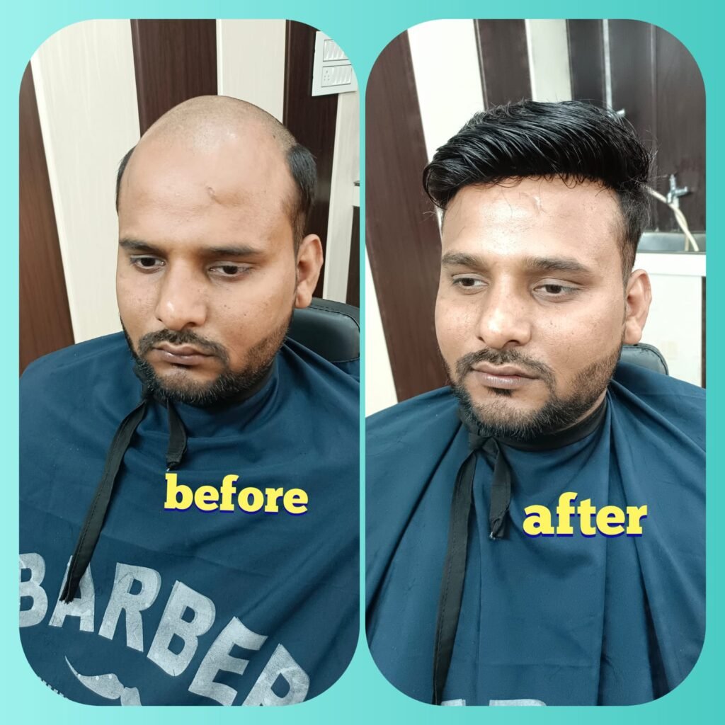 Hair Volumizing Services In Ghaziabad