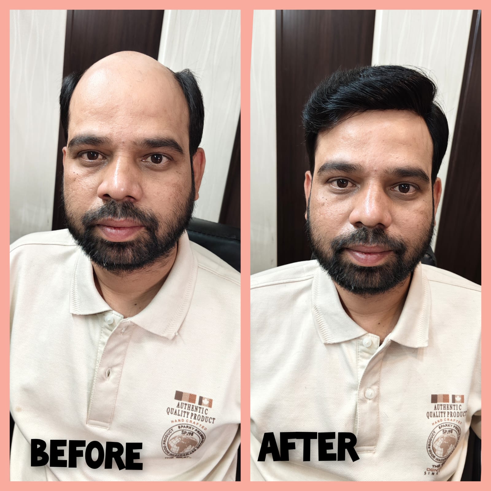 Best Hair Wig Service in Ghaziabad