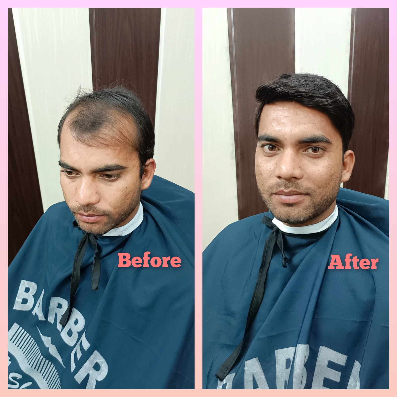 Hair Fixing Service in Ghaziabad